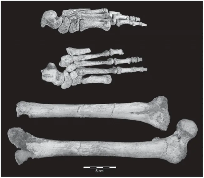 Figura 3. Vistas medial y dorsal del pie izquierdo de LB1, junto a su tibia derecha y fémur izquierdo. Fuente.