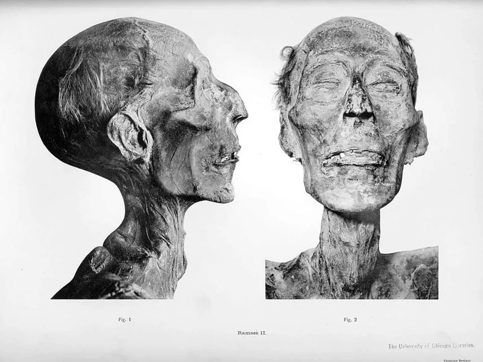 Figura 2. Imagen del rostro de la momia de Ramsés II. Fuente.